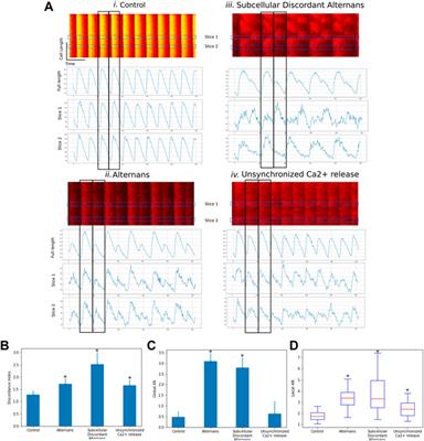 CardIAP: calcium transients confocal image analysis tool